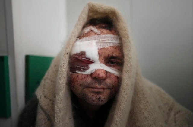 Rusko ostreľovalo objekty na západe Ukrajiny, útok si vyžiadal najmenej 35 obetí a desiatky zranených