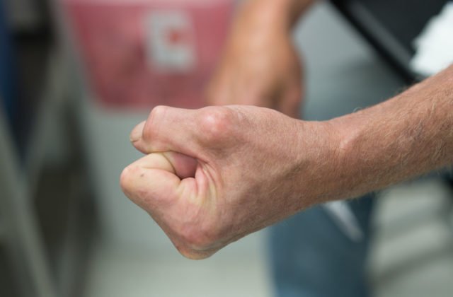 V električke sa strhla bitka pre respirátor, agresívny muž udieral druhého cestujúceho päsťami