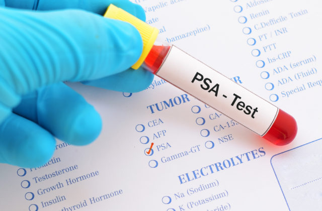 Mužom na vlastnej plodnosti záleží, do urologických ambulancií prichádzajú čoraz častejšie