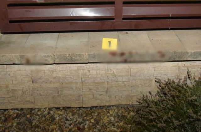 Pes v Krušovciach brutálne napadol tri maloleté dievčatá, všetky skončili v nemocnici