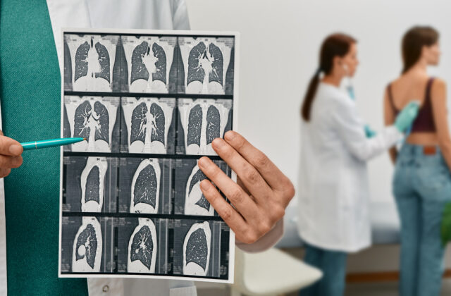 Pľúcna fibróza: Strach z diagnózy nesmie zostať bez slov