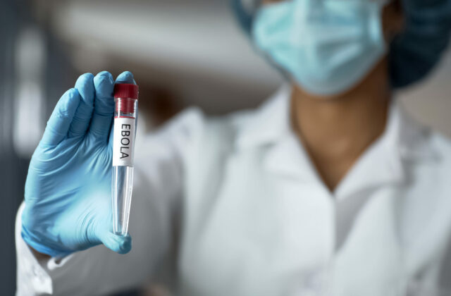 Európski ministri zdravotníctva budú v piatok mimoriadne rokovať o šírení eboly